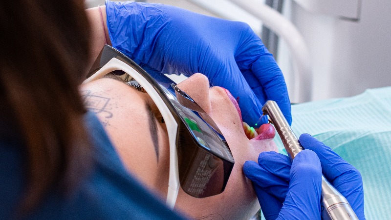 Primjene lasera u oralnoj kirurgiji: Preciznost u svakom zahvatu